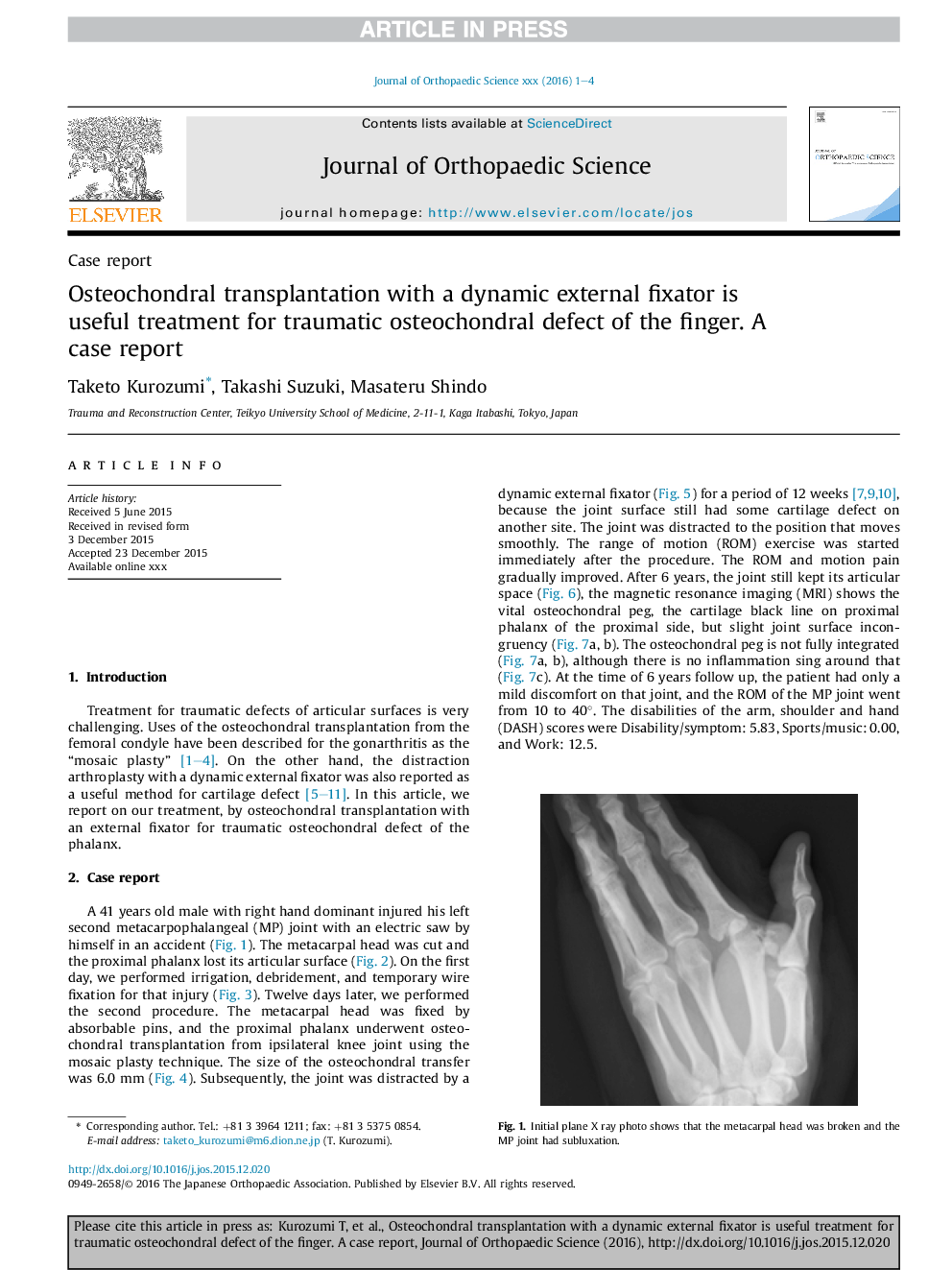 عکس صفحه اول مقاله: Osteochondral transplantation with a dynamic external fixator is useful treatment for traumatic osteochondral defect of the finger. A case report Osteochondral transplantation with a dynamic external fixator is useful treatment for traumatic osteochondral defect of the finger. A case report