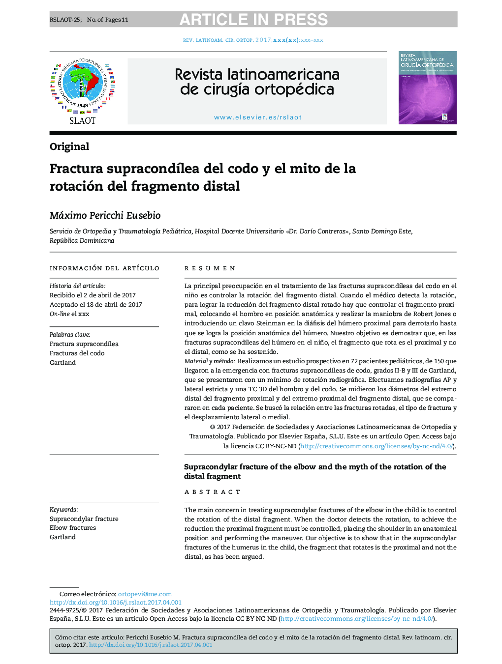 Fractura supracondÃ­lea del codo y el mito de la rotación del fragmento distal