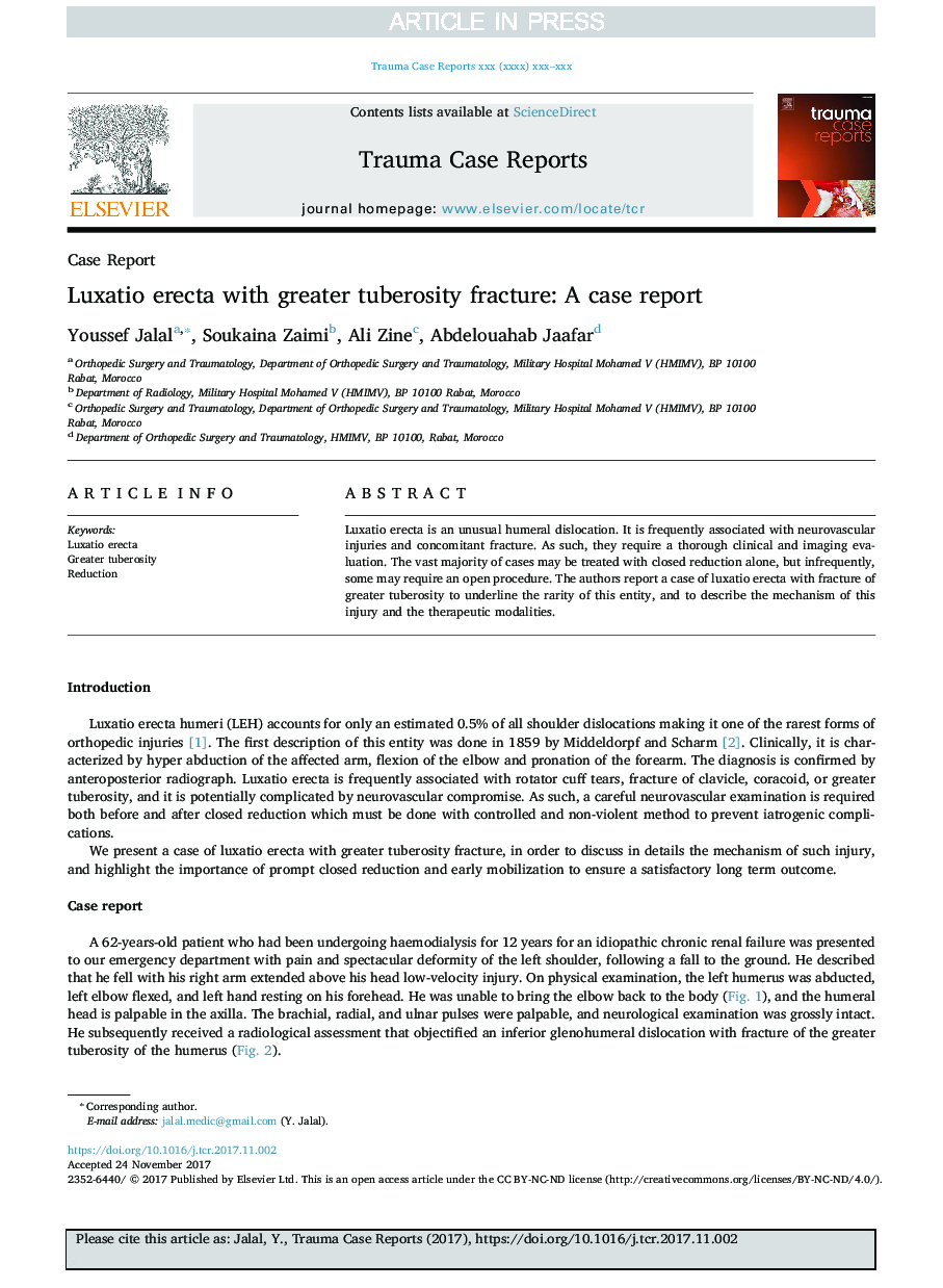 Luxatio erecta with greater tuberosity fracture: A case report