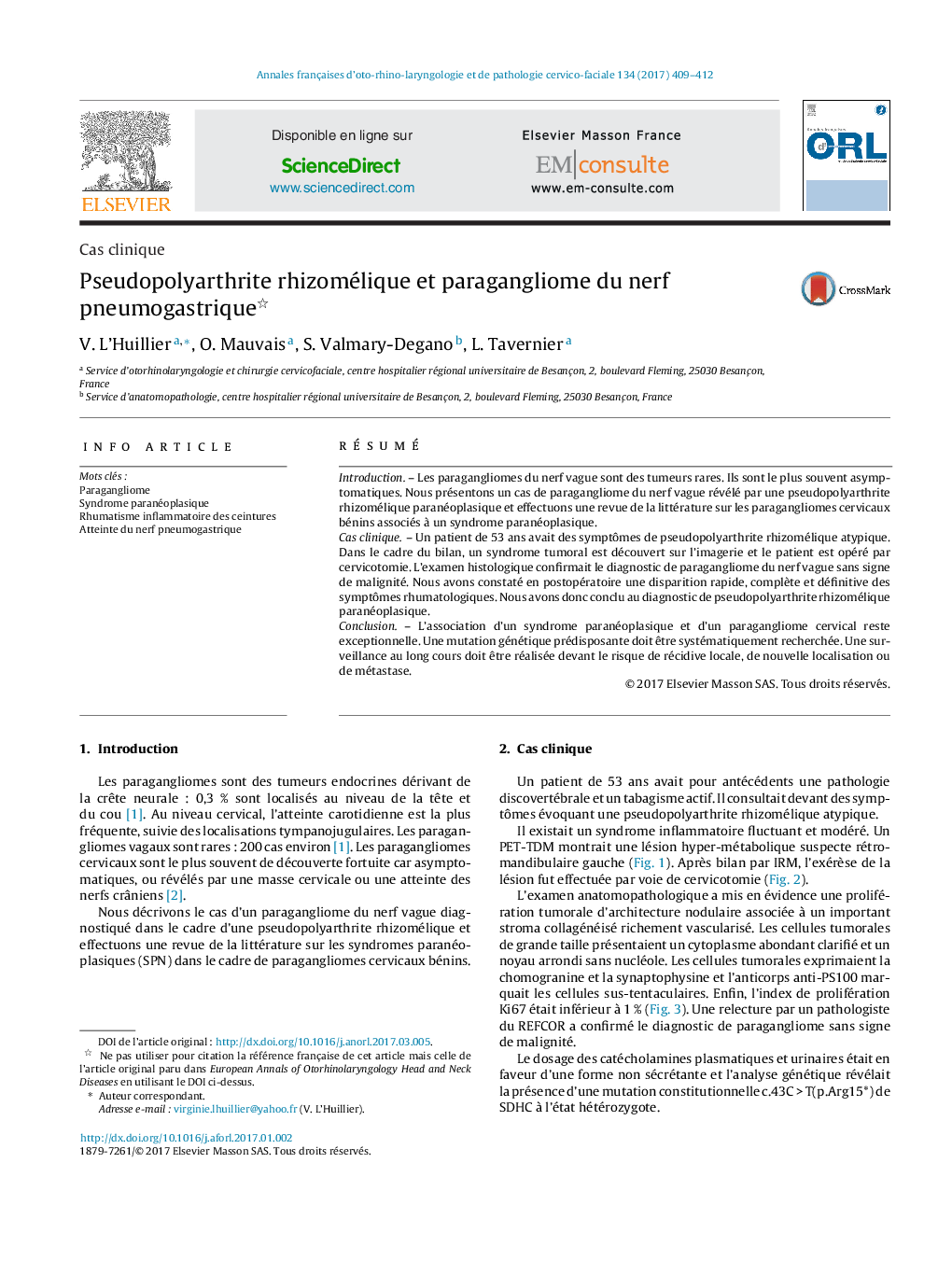 Pseudopolyarthrite rhizomélique et paragangliome du nerf pneumogastrique