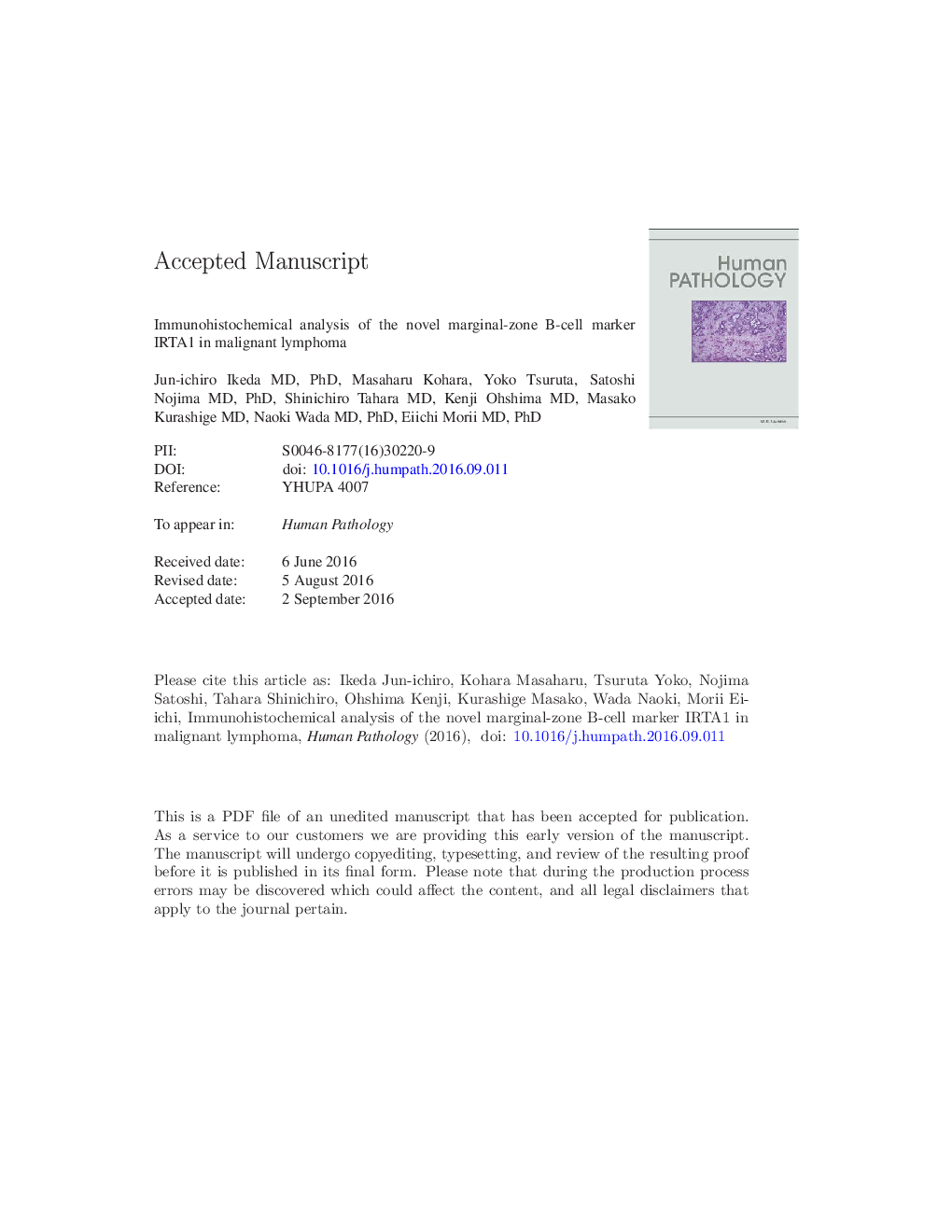 Immunohistochemical analysis of the novel marginal zone B-cell marker IRTA1 in malignant lymphoma