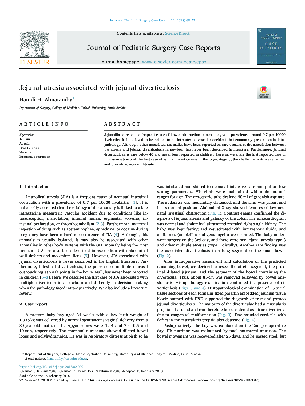 Jejunal atresia associated with jejunal diverticulosis