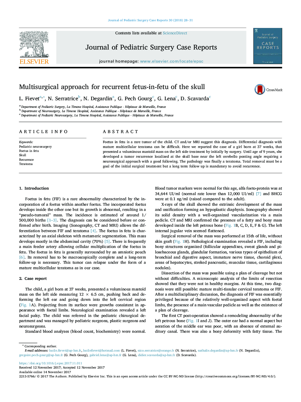 Multisurgical approach for recurrent fetus-in-fetu of the skull