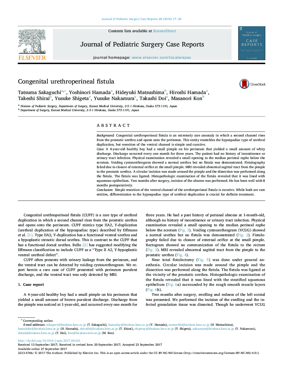 Congenital urethroperineal fistula