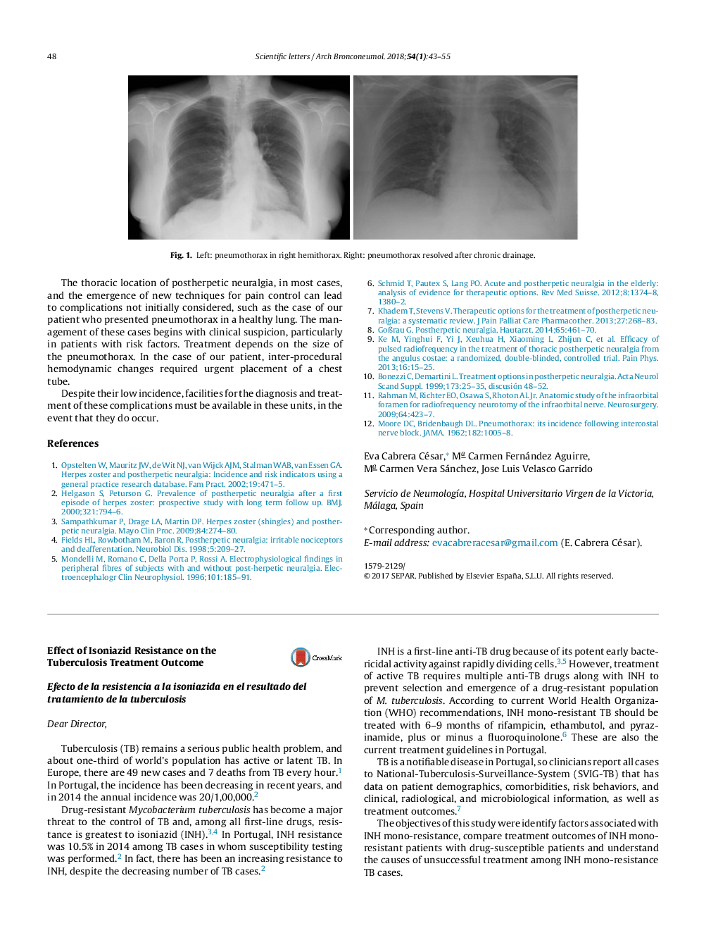 Effect of Isoniazid Resistance on the Tuberculosis Treatment Outcome