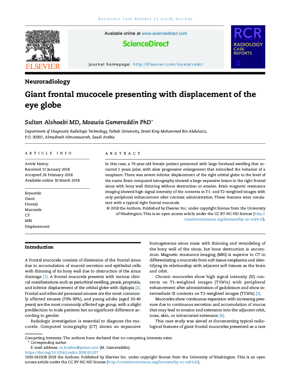 Giant frontal mucocele presenting with displacement of the eye globe