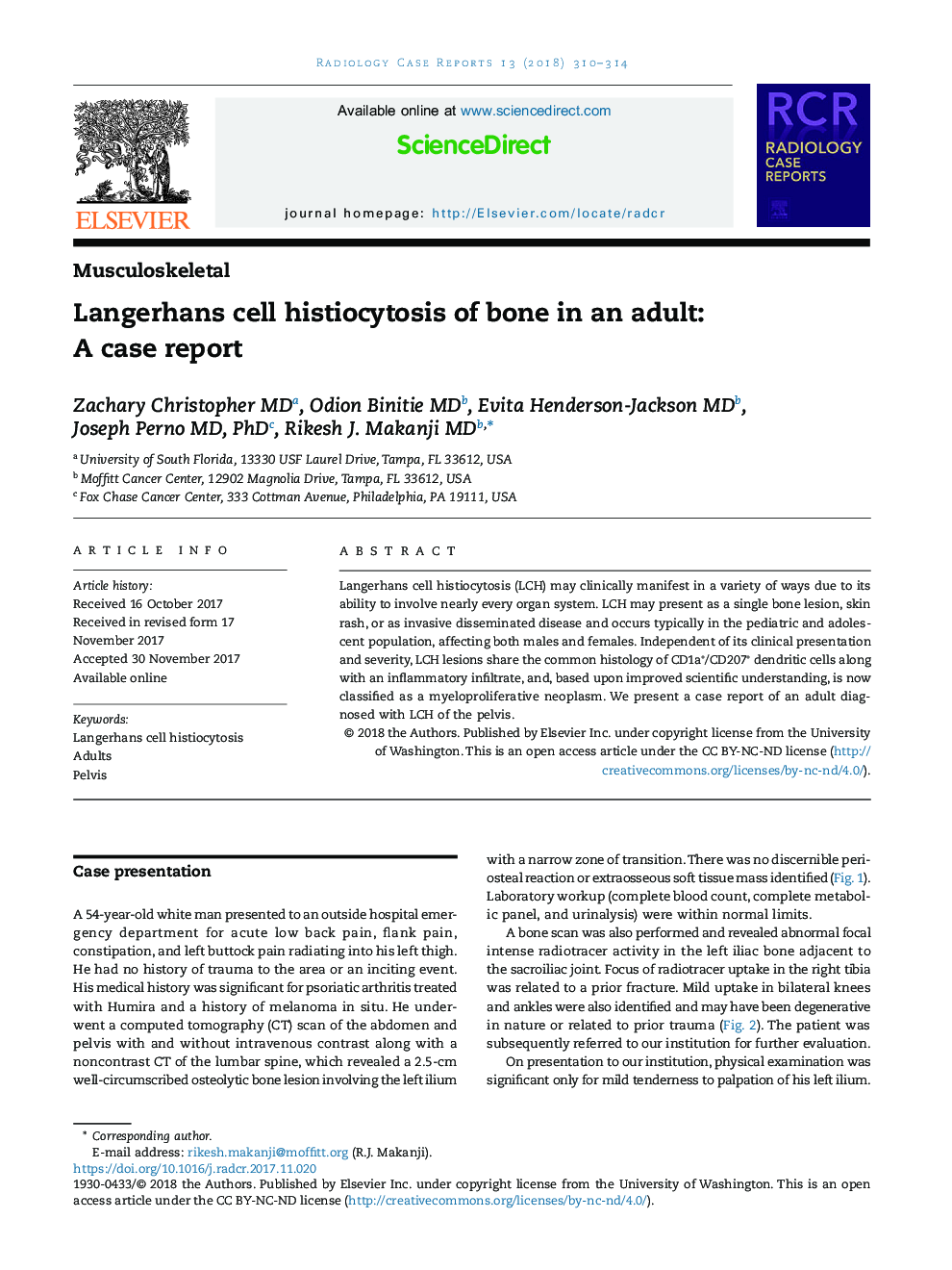 Langerhans cell histiocytosis of bone in an adult: A case report