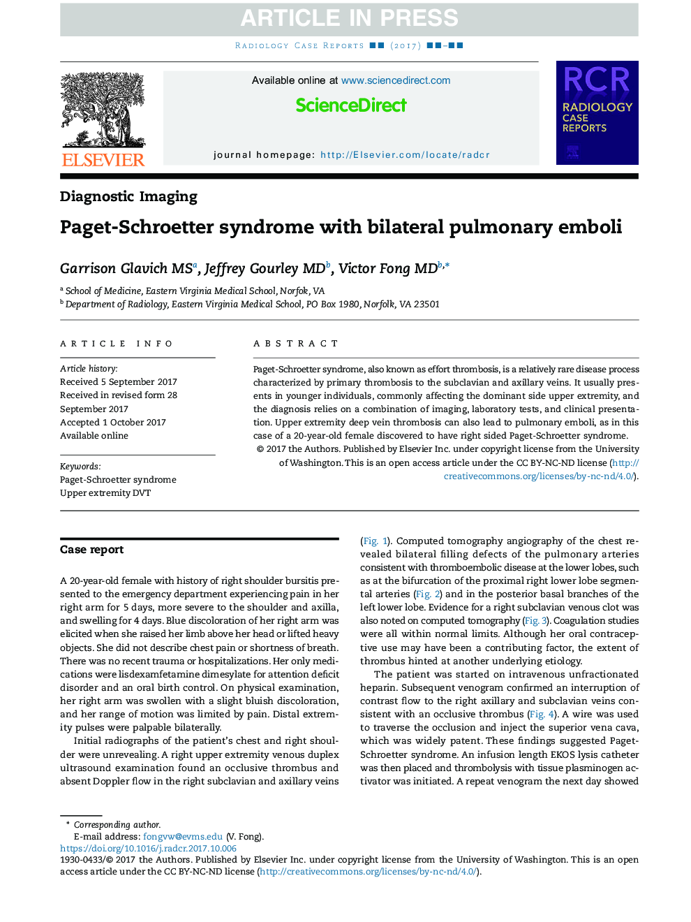 Paget-Schroetter syndrome with bilateral pulmonary emboli
