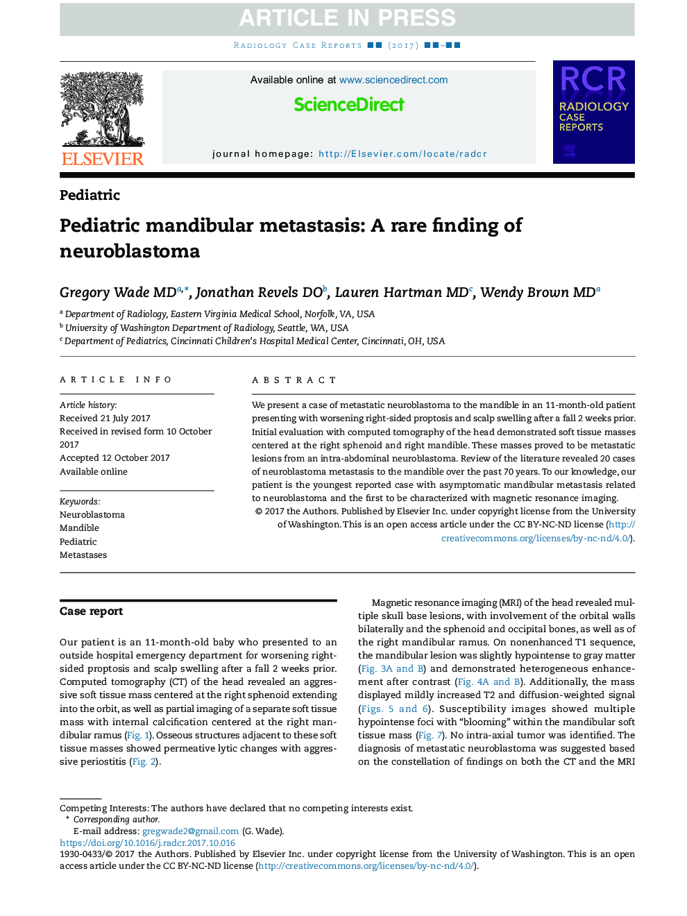 Pediatric mandibular metastasis: A rare finding of neuroblastoma