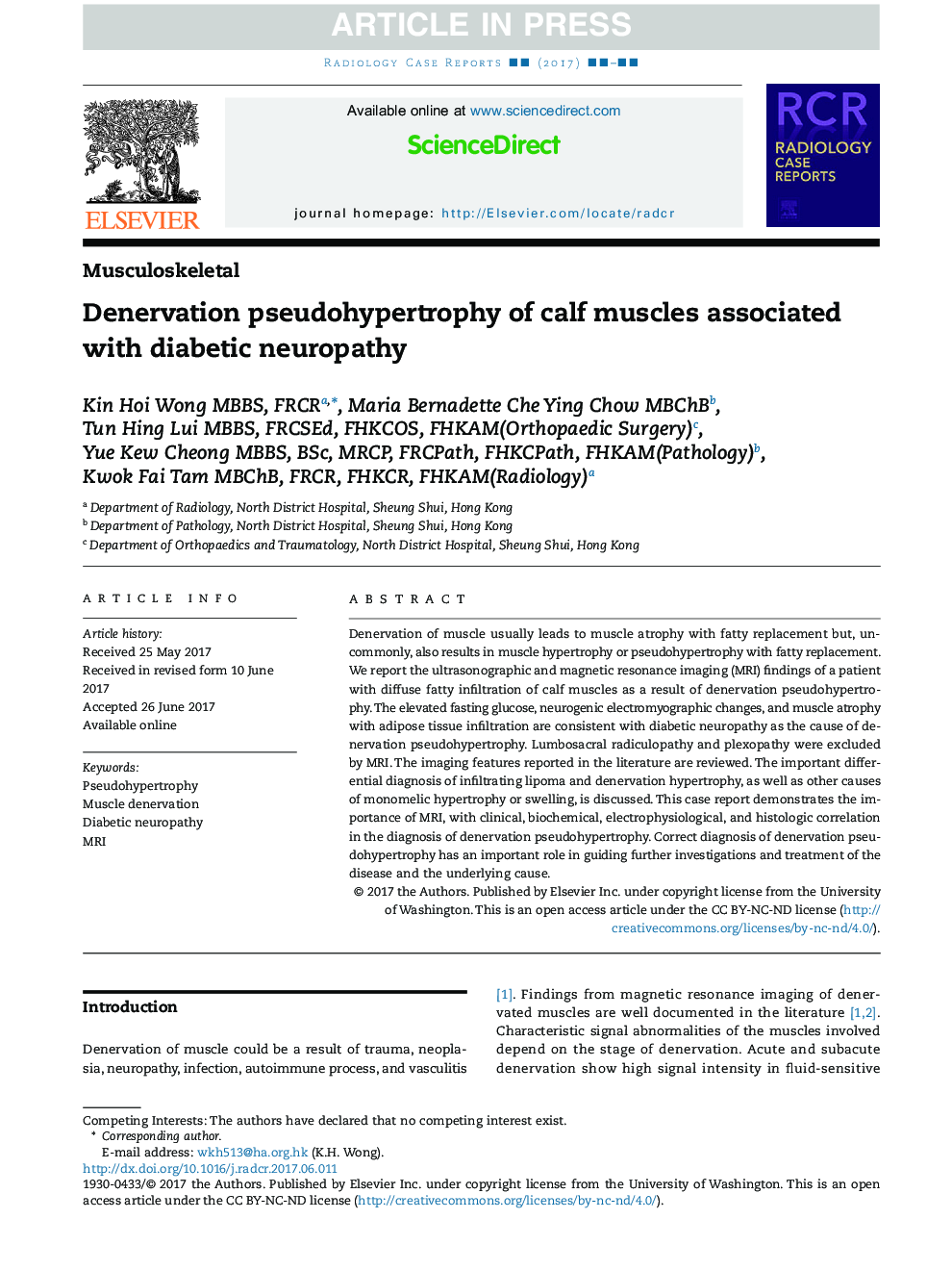 Denervation pseudohypertrophy of calf muscles associated with diabetic neuropathy