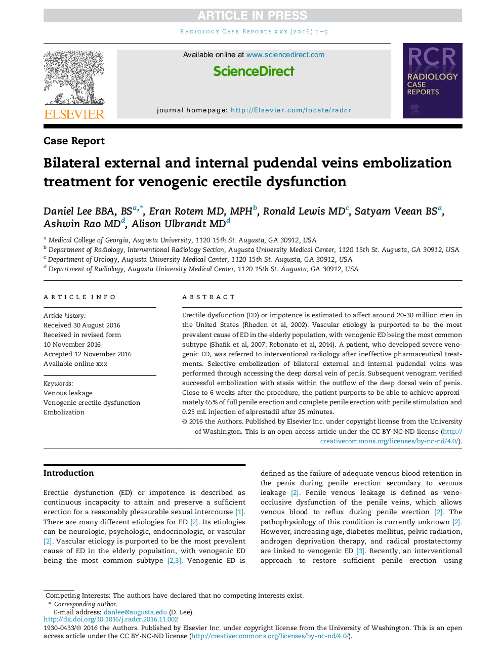 Bilateral external and internal pudendal veins embolization treatment for venogenic erectile dysfunction