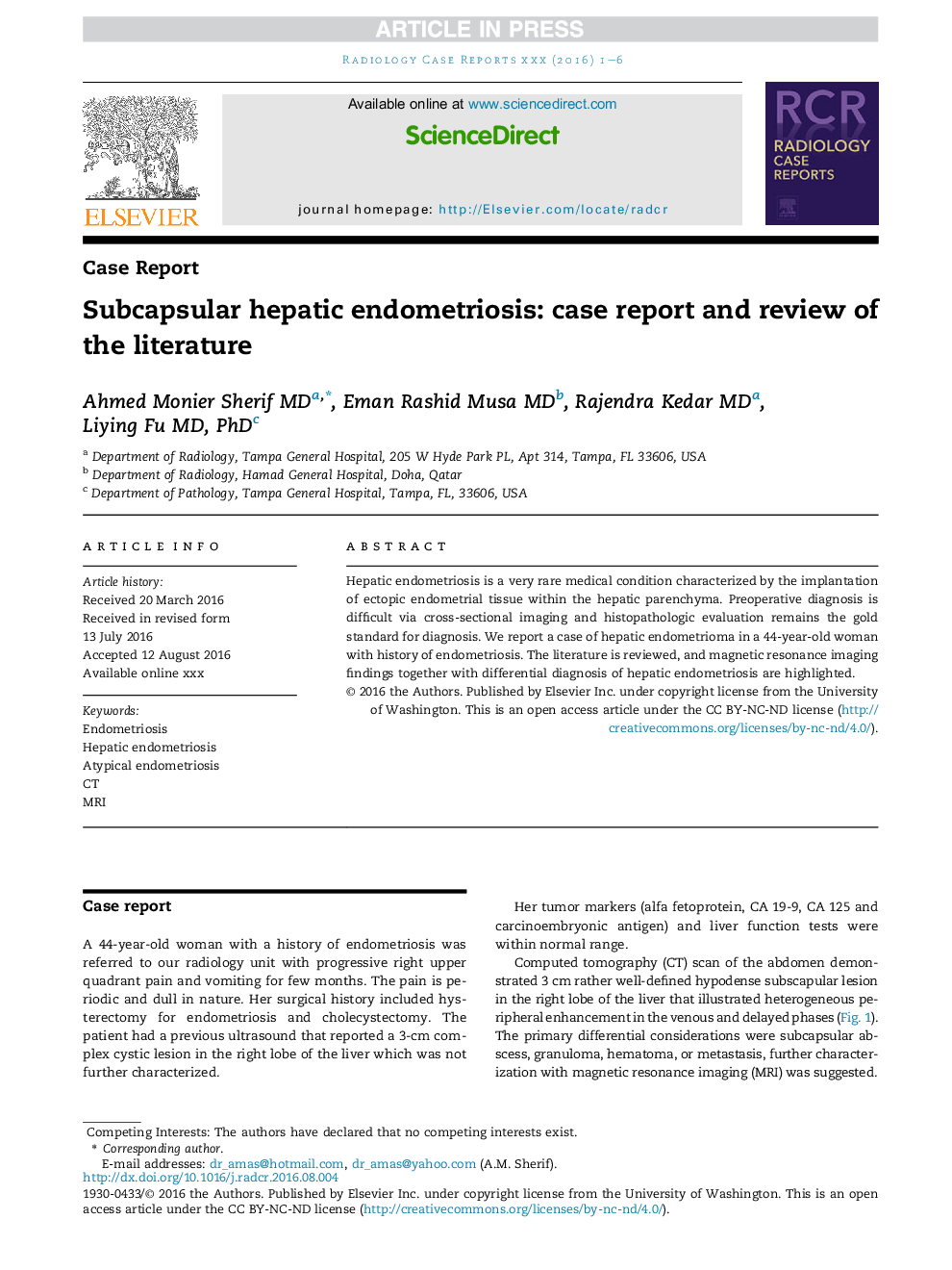 Subcapsular hepatic endometriosis: case report and review of the literature