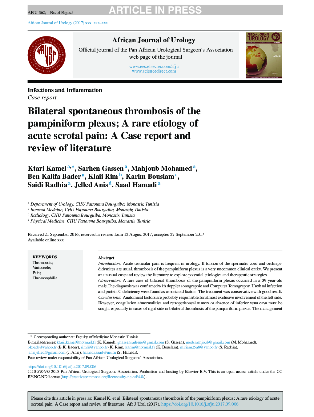 Bilateral spontaneous thrombosis of the pampiniform plexus; A rare etiology of acute scrotal pain: A case report and review of literature