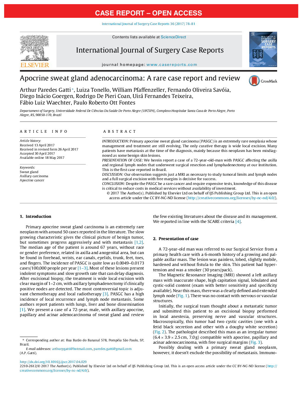 Apocrine sweat gland adenocarcinoma: A rare case report and review