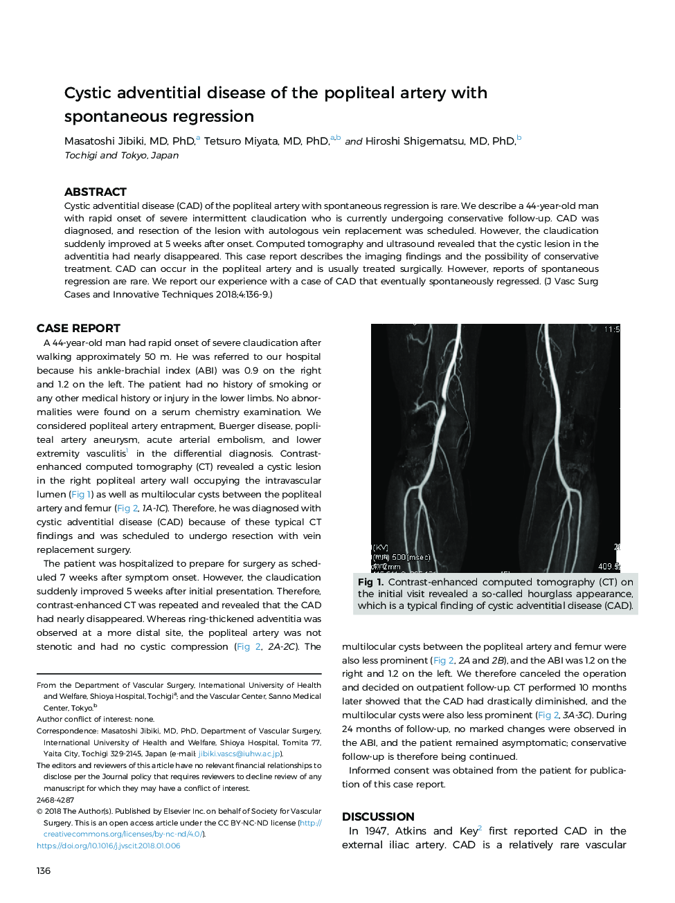 Cystic adventitial disease of the popliteal artery with spontaneous regression