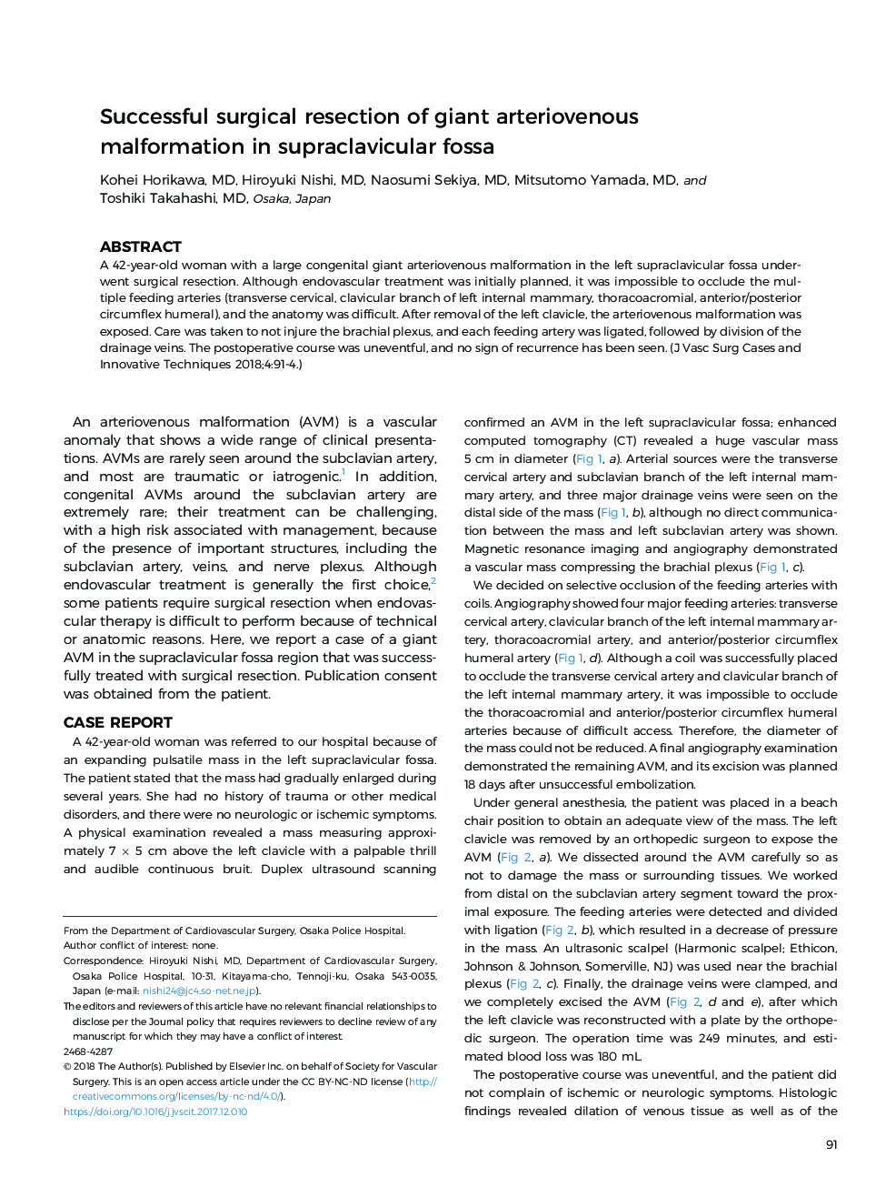Successful surgical resection of giant arteriovenous malformation in supraclavicular fossa