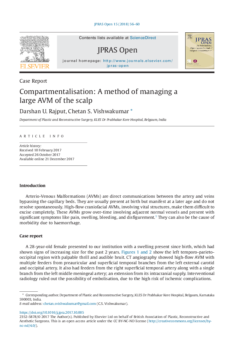 Compartmentalisation: A method of managing a large AVM of the scalp