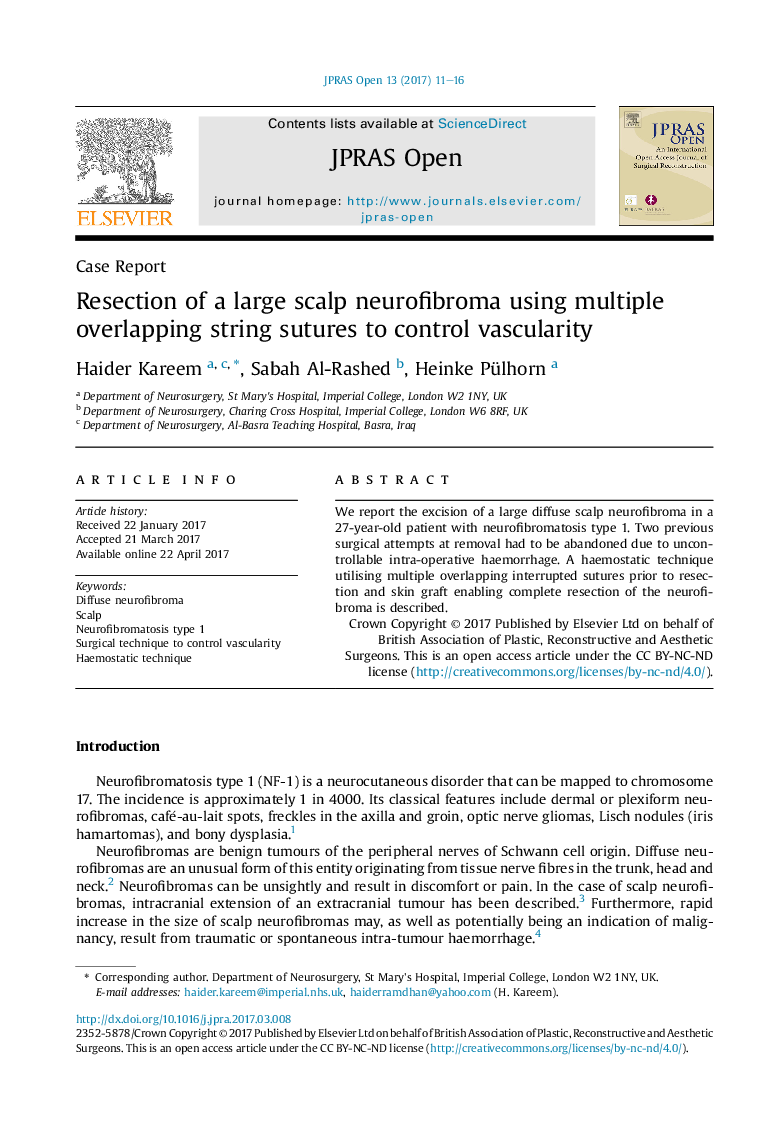 برداشتن یک نوروفیبرومای پوست سر با استفاده از چند بخیه رشته ای همپوشانی برای کنترل عروق کرونری 