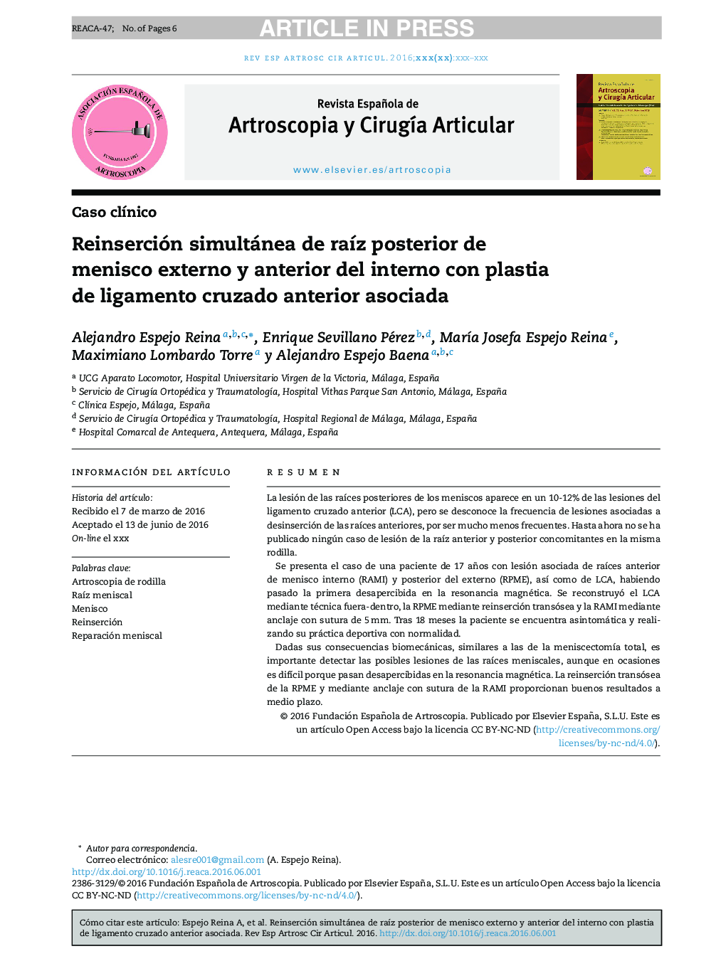 Reinserción simultánea de raÃ­z posterior de menisco externo y anterior del interno con plastia de ligamento cruzado anterior asociada