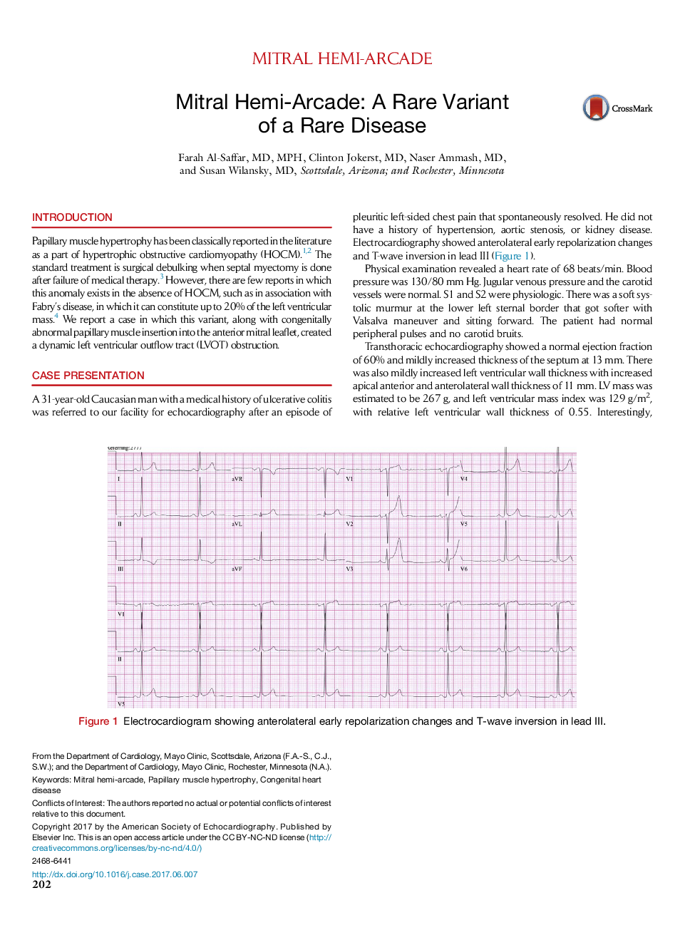 عکس صفحه اول مقاله: Mitral Hemi-Arcade: A Rare Variant of a Rare Disease Mitral Hemi-Arcade: A Rare Variant of a Rare Disease