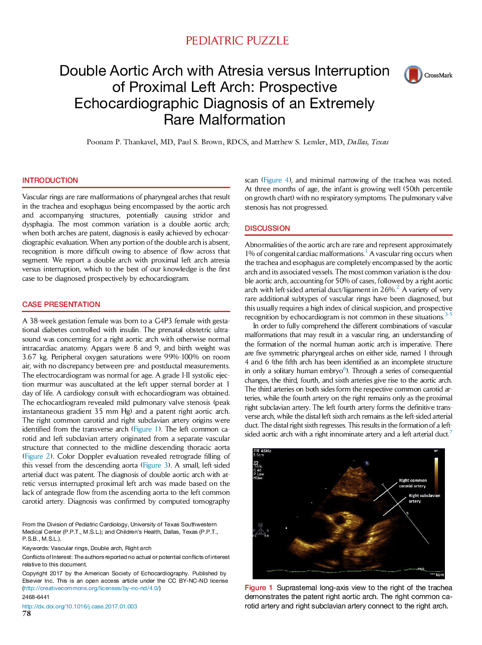 Double Aortic Arch with Atresia versus Interruption of Proximal Left Arch: Prospective Echocardiographic Diagnosis of an Extremely RareÂ Malformation