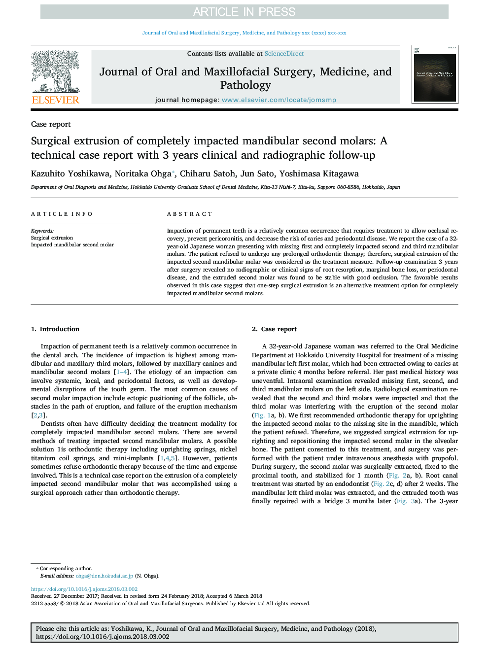 Surgical extrusion of completely impacted mandibular second molars: A technical case report with 3 years clinical and radiographic follow-up