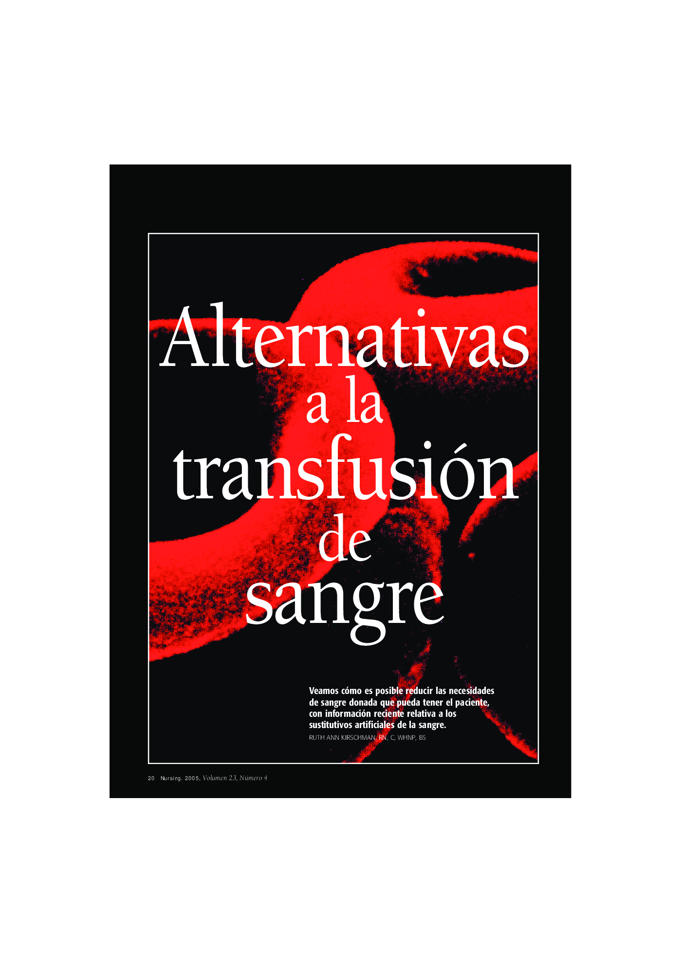 Alternativas a la transfusión de sangre