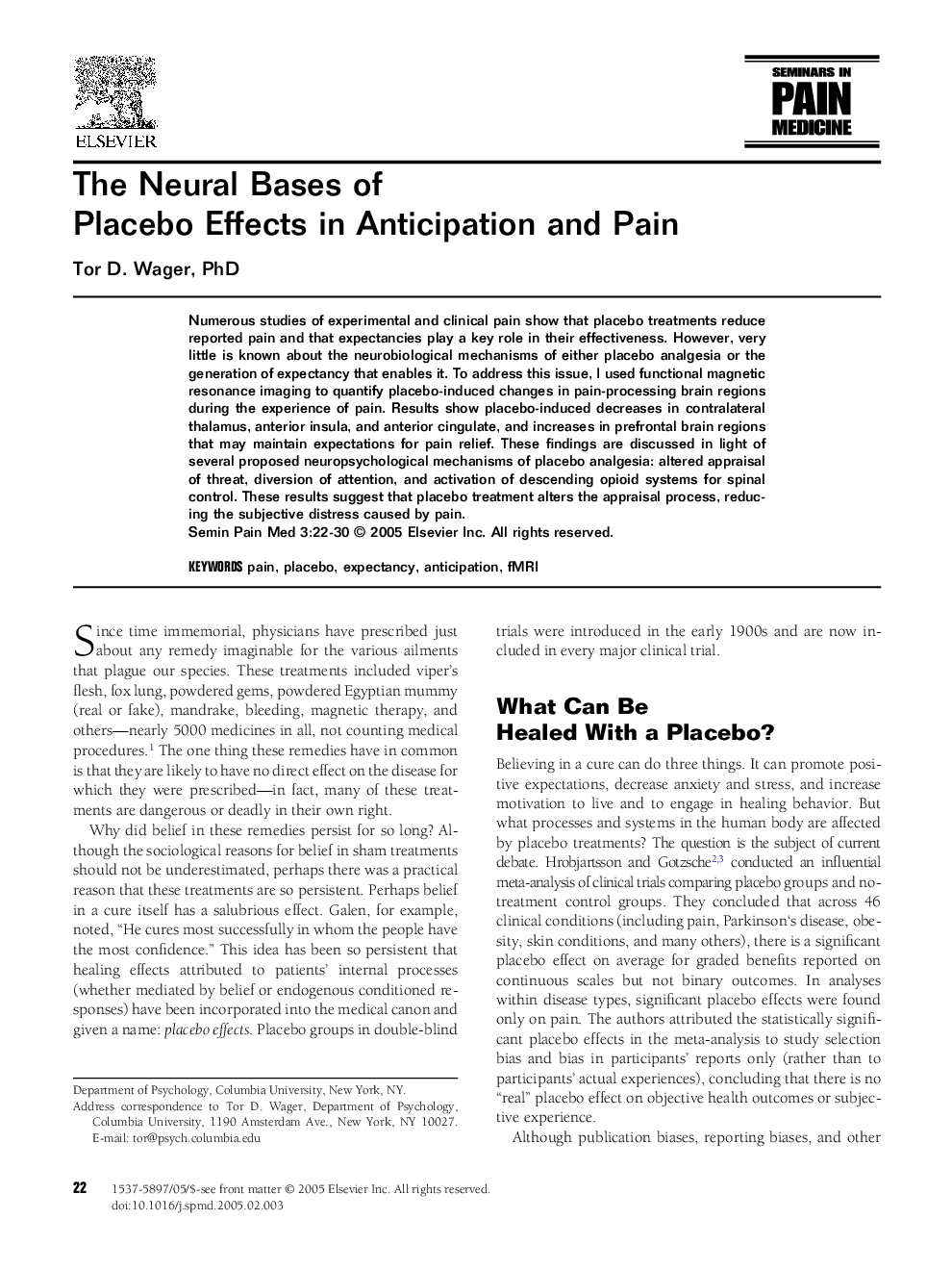 The neural bases of placebo effects in anticipation and pain