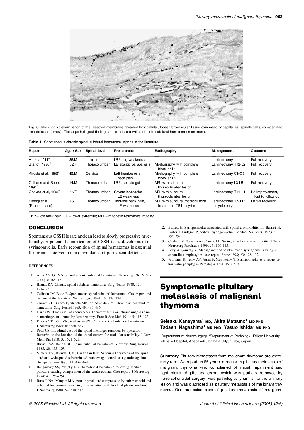 Symptomatic pituitary metastasis of malignant thymoma