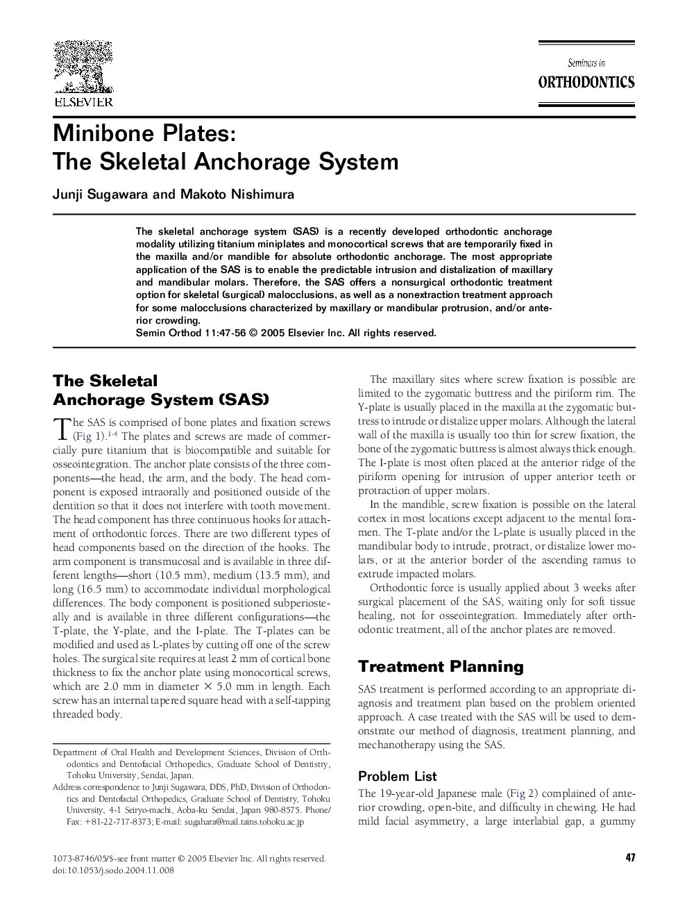 Minibone plates: The skeletal anchorage system