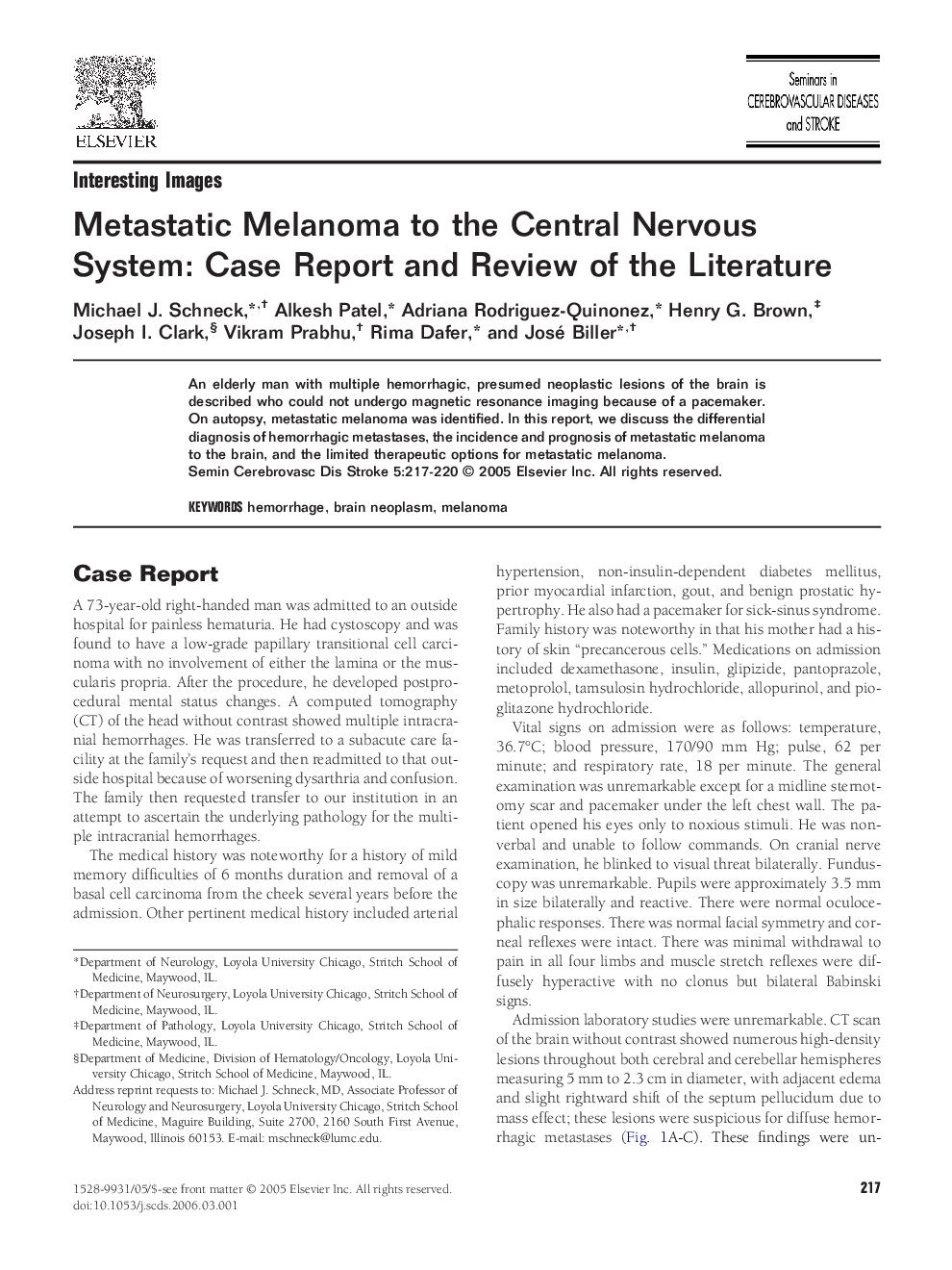 Metastatic Melanoma to the Central Nervous System: Case Report and Review of the Literature