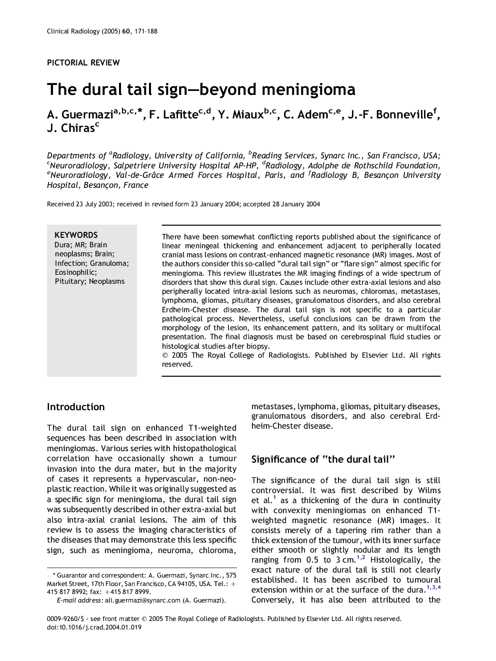 The dural tail sign-beyond meningioma