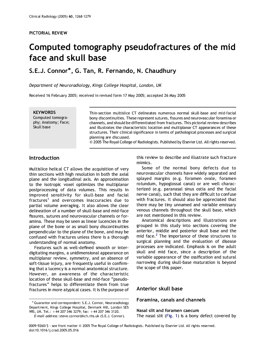 Computed tomography pseudofractures of the mid face and skull base