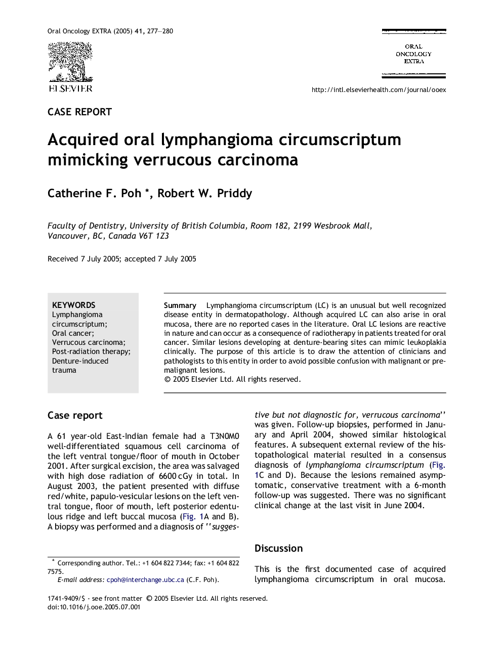 Acquired oral lymphangioma circumscriptum mimicking verrucous carcinoma