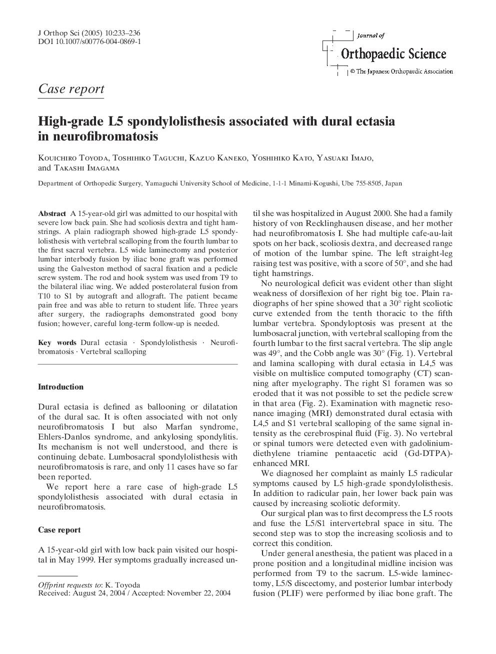 عکس صفحه اول مقاله: High-grade L5 spondylolisthesis associated with dural ectasia in neurofibromatosis High-grade L5 spondylolisthesis associated with dural ectasia in neurofibromatosis