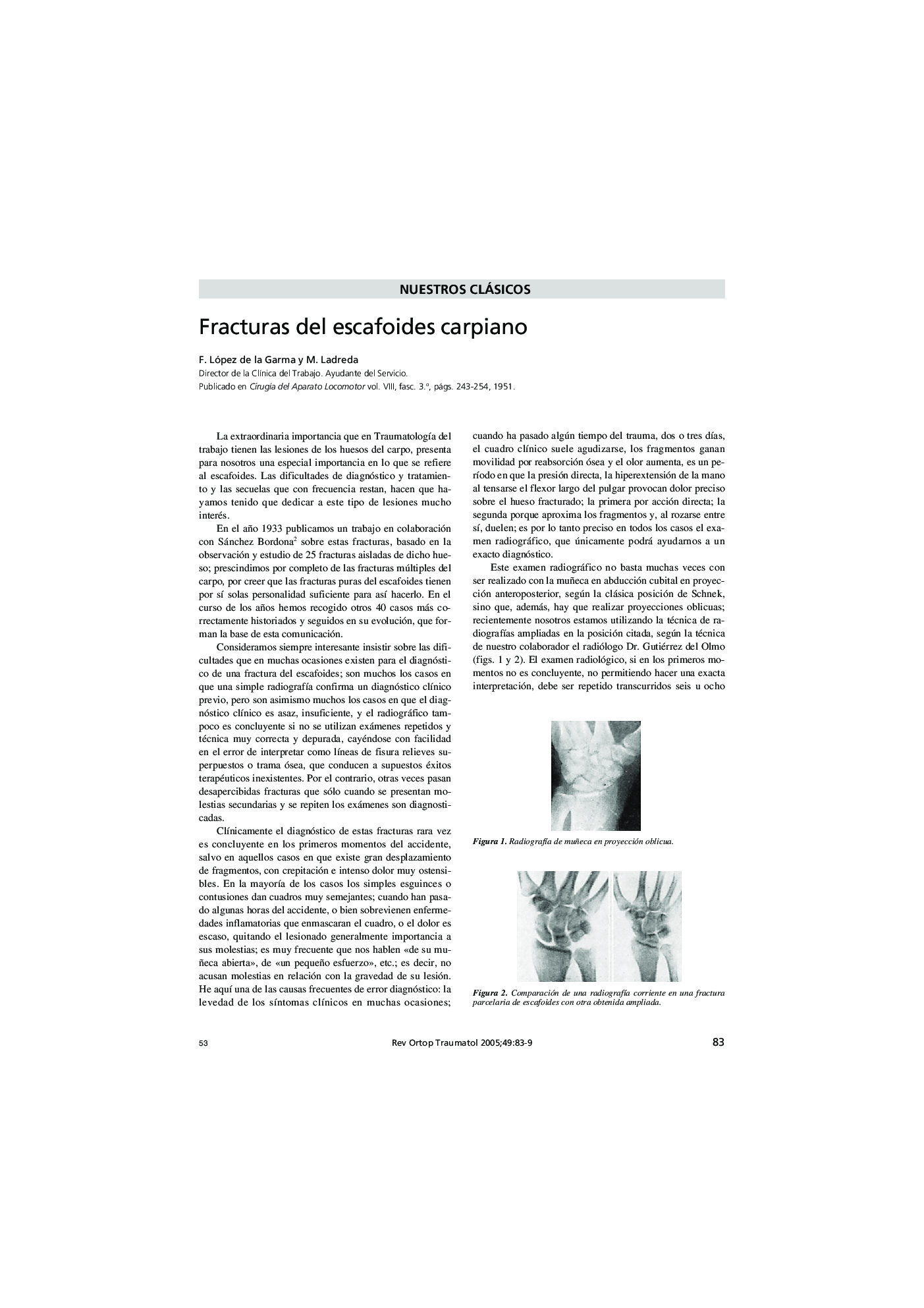 عکس صفحه اول مقاله: Fracturas del escafoides carpiano Fracturas del escafoides carpiano