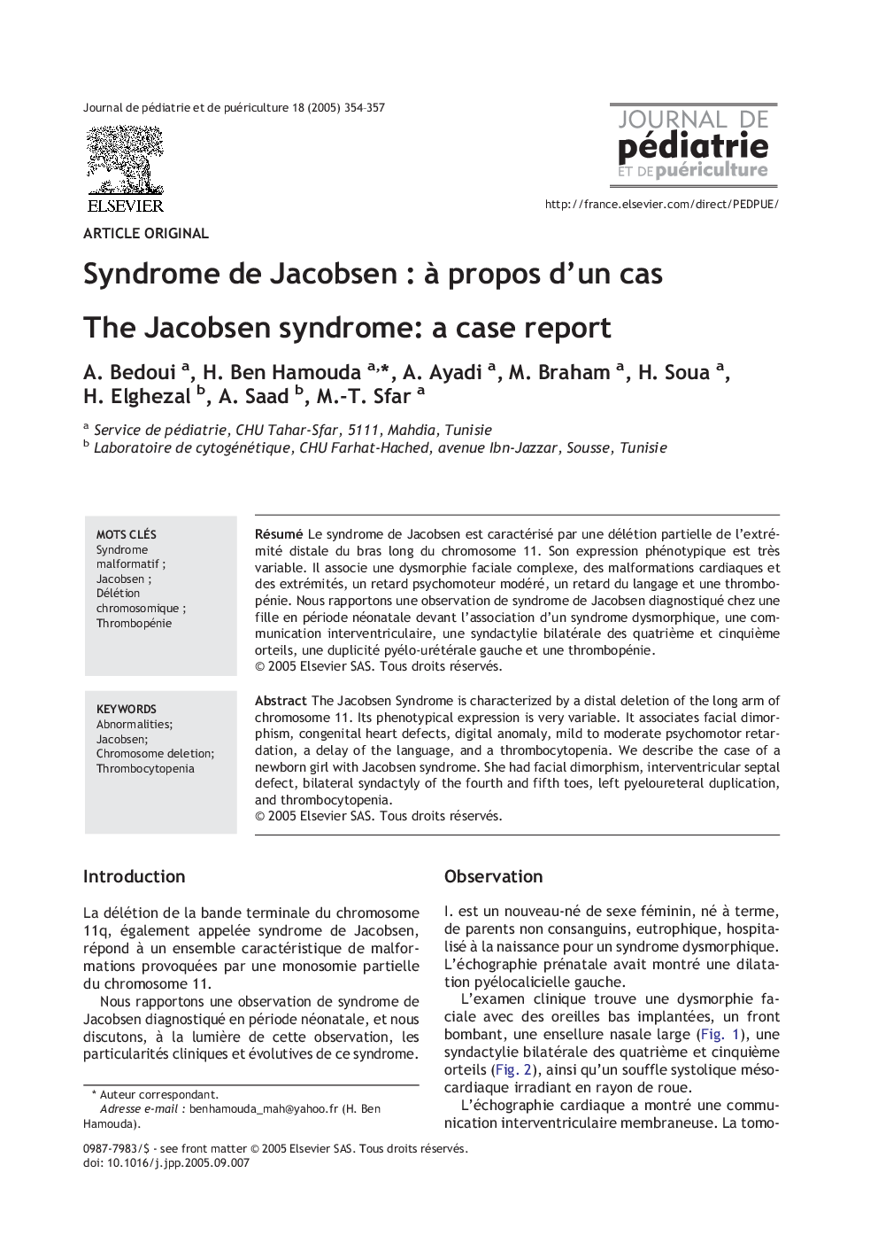 Syndrome de JacobsenÂ : Ã  propos d'un cas