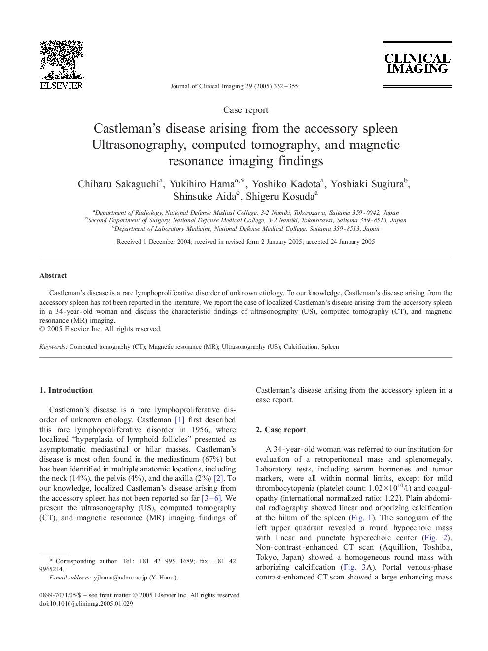 Castleman's disease arising from the accessory spleen