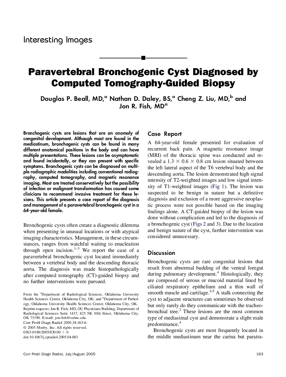 Paravertebral Bronchogenic Cyst Diagnosed by Computed Tomography-Guided Biopsy
