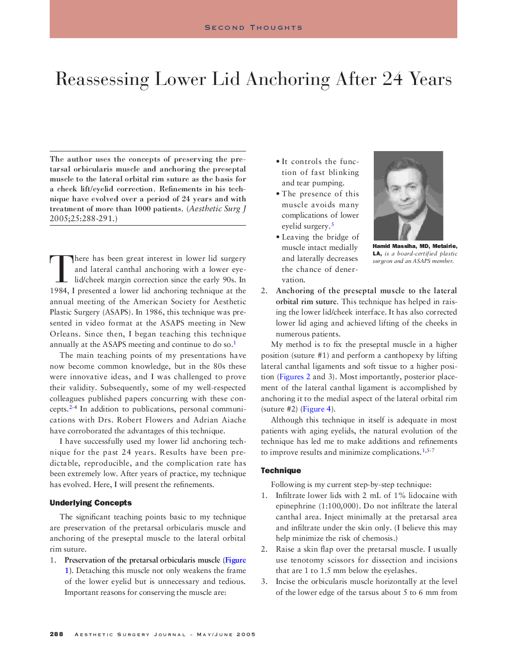 Reassessing lower lid anchoring after 24 years