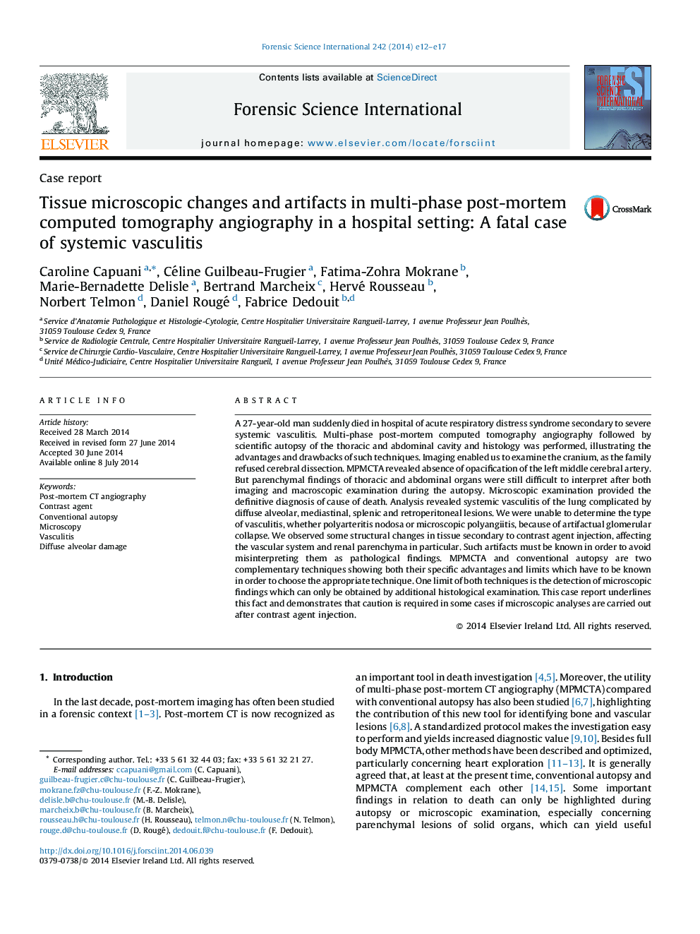 Tissue microscopic changes and artifacts in multi-phase post-mortem computed tomography angiography in a hospital setting: A fatal case of systemic vasculitis