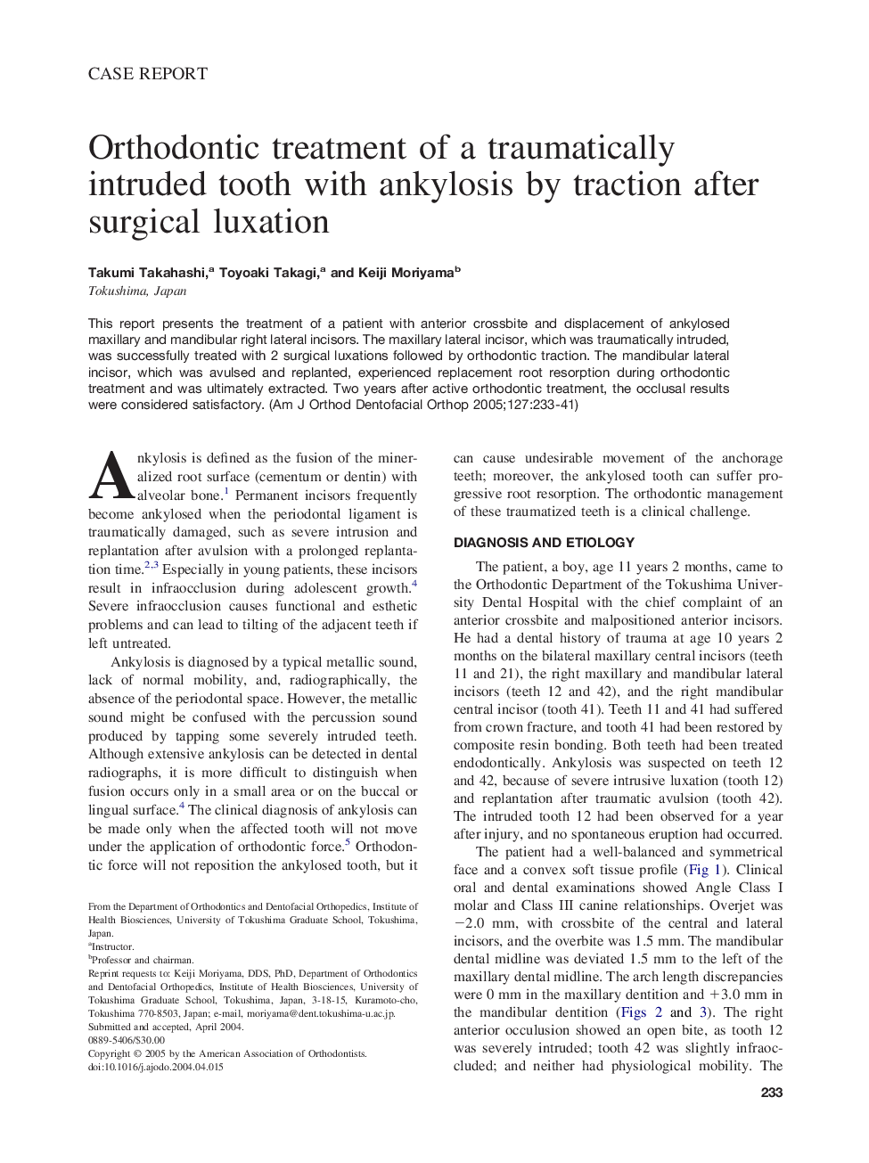 Orthodontic treatment of a traumatically intruded tooth with ankylosis by traction after surgical luxation